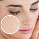 Perawatan wajah kusam