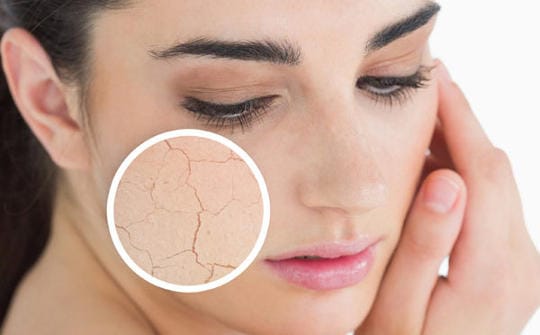 Perawatan wajah kusam